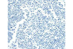 Immunohistochemistry (IHC) image for anti-TNF Receptor-Associated Factor 3 (TRAF3) antibody (ABIN1875193)