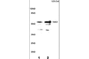 L1 and L2 rat brain lysates probed with Anti Phospho-CaMKII (Thr286) Polyclonal Antibody, Unconjugated (ABIN732473) at 1:200 overnight at 4 °C. (CAMK2B antibody  (pThr287))