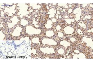 Immunohistochemistry (IHC) image for anti-Neighbor of BRCA1 Gene 1 (NBR1) antibody (ABIN5957970) (NBR1 antibody)