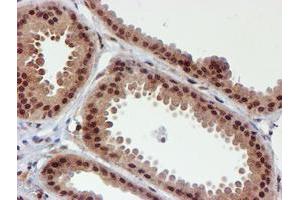 Immunohistochemical staining of paraffin-embedded Human breast tissue using anti-CYP17A1 mouse monoclonal antibody. (CYP17A1 antibody)