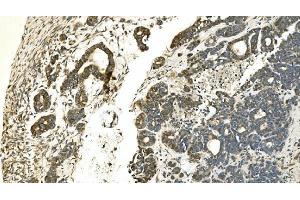 IHC analysis of Carbonic Anhydrase 13/CA13 using anti-Carbonic Anhydrase 13/CA13 antibody (ABIN7603164). (CA13 antibody  (N-Term))