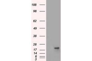 Image no. 2 for anti-Crystallin, alpha B (CRYAB) antibody (ABIN1497646) (CRYAB antibody)