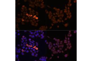 Immunofluorescence analysis of HeLa-Myc-CandHeLa cells using Rabbit anti Myc-Tag pAb-C-terminal (ABIN3020568 and ABIN3020569) at dilution of 1:100 (40x lens). (Myc Tag antibody)