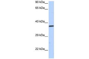 Western Blotting (WB) image for anti-Sex Comb On Midleg-Like 1 (SCML1) antibody (ABIN2458174)