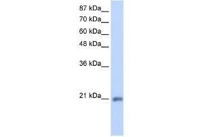 WB Suggested Anti-MIF4GD Antibody Titration:  1.