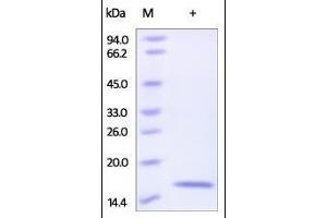 Human Reg4, His Tag on SDS-PAGE under reducing (R) condition. (REG4 Protein (AA 23-158) (His tag))
