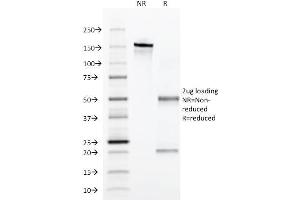 SDS-PAGE Analysis Purified Alpha-1-Antitrypsin Mouse Monoclonal Antibody (AAT/1379). (SERPINA1 antibody)