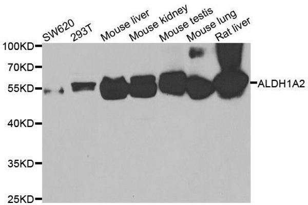 ALDH1A2 antibody  (AA 1-180)