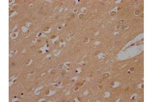 IHC image of ABIN7140049 diluted at 1:200 and staining in paraffin-embedded human brain tissue performed on a Leica BondTM system. (LPPR1 antibody  (AA 51-66))
