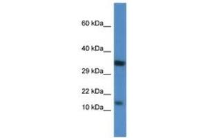 Image no. 1 for anti-Protein Kinase (CAMP-Dependent, Catalytic) Inhibitor beta (PKIB) (AA 40-89) antibody (ABIN6746525) (PKIB antibody  (AA 40-89))