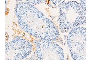 ABIN6267267 at 1/100 staining mouse testicular tissue sections by IHC-P. (EGFR antibody  (pSer695))