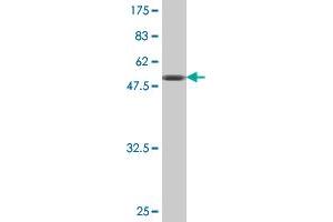 Western Blot detection against Immunogen (51. (TK1 antibody  (AA 1-234))