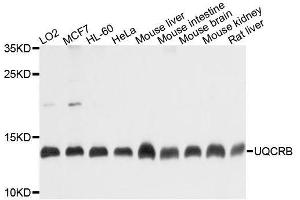 Western blot analysis of extracts of various cell lines, using UQCRB antibody. (UQCRB antibody  (AA 1-111))