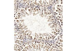 Immunohistochemistry of paraffin embedded rat testis using CDY1 (ABIN7073493) at dilution of 1:400 (300x lens) (CDY1 antibody)
