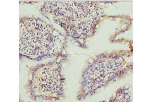 Immunohistochemistry of paraffin-embedded human small intestine tissue using ABIN7171763 at dilution of 1:100 (TNS3 antibody  (AA 1-240))