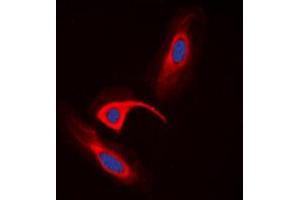 Immunofluorescent analysis of CBR1 staining in HeLa cells. (CBR1 antibody  (Center))