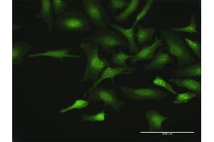 Immunofluorescence of purified MaxPab antibody to CTDSP2 on HeLa cell. (CTDSP2 antibody  (AA 1-271))
