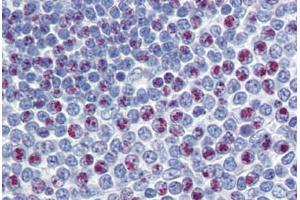 Spleen, Human: Formalin-Fixed, Paraffin-Embedded (FFPE) (FOXM1 antibody  (C-Term))
