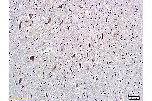 Formalin-fixed and paraffin embedded rat brain labeled with Anti-GRM5/mGluR5 Polyclonal Antibody, Unconjugated (ABIN673914) followed by conjugation to the secondary antibody and DAB staining