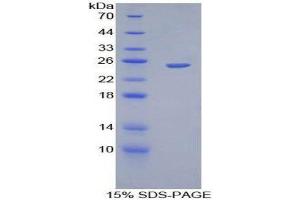 SDS-PAGE (SDS) image for Chromogranin B (Secretogranin 1) (CHGB) (AA 496-669) protein (His tag,GST tag) (ABIN1879868) (CHGB Protein (AA 496-669) (His tag,GST tag))