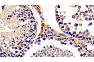 Detection of HMGCS2 in Mouse Testis Tissue using Polyclonal Antibody to Hydroxymethylglutaryl Coenzyme A Synthase 2, Mitochondrial (HMGCS2) (HMGCS2 antibody  (AA 1-167))