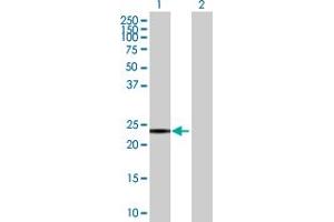 Western Blot analysis of SNAP23 expression in transfected 293T cell line by SNAP23 MaxPab polyclonal antibody. (SNAP23 antibody  (AA 1-211))