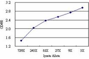 CA12 (Human) Matched Antibody Pair