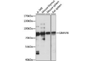 Western blot analysis of extracts of various cell lines, using GIMAP8 antibody (ABIN6293171) at 1:1000 dilution. (GIMAP8 antibody)