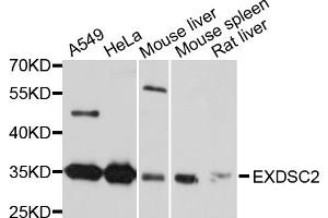 Western blot analysis of extracts of various cell lines, using EXOSC2 antibody (ABIN4903619) at 1:1000 dilution. (EXOSC2 antibody)
