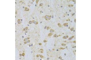 Immunohistochemistry of paraffin-embedded rat brain using EEF1B2 Antibody. (EEF1B2 antibody  (AA 1-225))