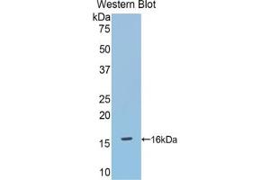Western blot analysis of the recombinant protein. (DBR1 antibody  (AA 133-241))
