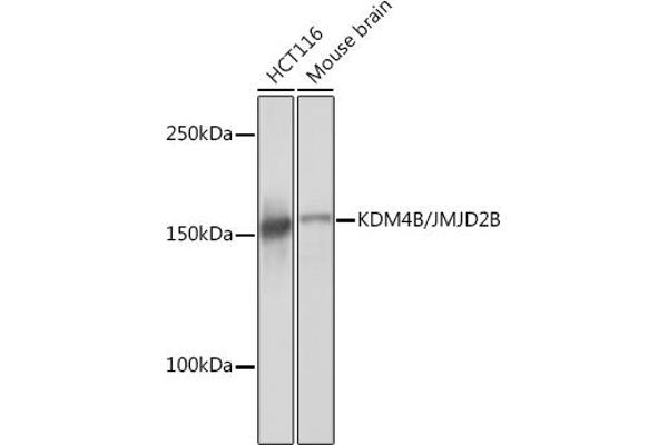 KDM4B antibody