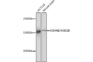 KDM4B Antikörper