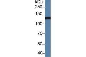 Detection of CD11b in Mouse Serum using Polyclonal Antibody to Integrin Alpha M (CD11b) (CD11b antibody  (AA 808-931))