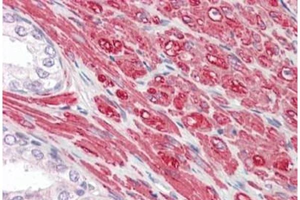 GREM2 antibody  (AA 107-168)