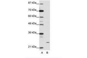 Image no. 1 for anti-Zinc Finger Protein 253 (ZNF253) (C-Term) antibody (ABIN202147) (ZNF253 antibody  (C-Term))