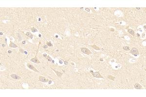 Immunohistochemistry (IHC) image for anti-A Kinase (PRKA) Anchor Protein 12 (AKAP12) (AA 1485-1782) antibody (ABIN7443371)