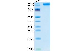 SDS-PAGE (SDS) image for SARS-CoV-2 Spike S1 (B.1.1.529 - Omicron) protein (His tag) (ABIN7274393)