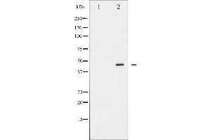 Western blot analysis of E2F1 expression in Etoposide treated HeLa whole cell lysates,The lane on the left is treated with the antigen-specific peptide. (E2F1 antibody  (C-Term))