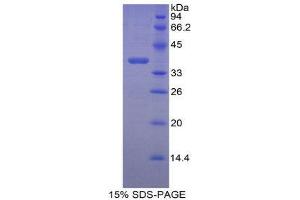 SDS-PAGE (SDS) image for Lumican (LUM) (AA 19-338) protein (His tag) (ABIN2121558) (LUM Protein (AA 19-338) (His tag))