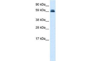 Human Lung; WB Suggested Anti-ZNF499 Antibody Titration: 0. (ZBTB45 antibody  (Middle Region))