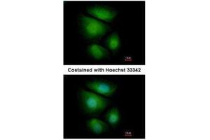 ICC/IF Image Immunofluorescence analysis of paraformaldehyde-fixed MCF-7, using RNF13, antibody at 1:500 dilution. (RNF13 antibody  (C-Term))