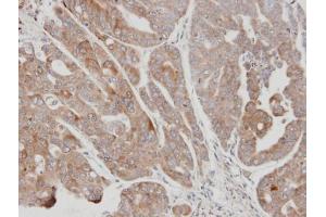 IHC-P Image Immunohistochemical analysis of paraffin-embedded N87 xenograft, using USP15, antibody at 1:100 dilution. (USP15 antibody  (C-Term))