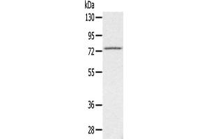 Gel: 6 % SDS-PAGE,Lysate: 40 μg,Primary antibody: ABIN7192448(SLC26A5 Antibody) at dilution 1/200 dilution,Secondary antibody: Goat anti rabbit IgG at 1/8000 dilution,Exposure time: 3 minutes (SLC26A5 antibody)