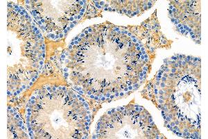 ABIN6263228 and ABIN6273139 at 1/100 staining Mouse testis tissue by IHC-P. (MEST antibody  (C-Term))