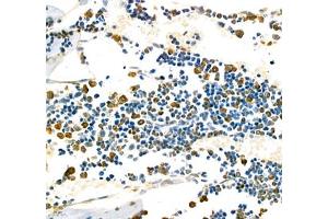 Immunohistochemistry of paraffin embedded mouse bone using CD110 (ABIN7074718) at dilution of 1:1000 (400x lens) (MPL antibody)