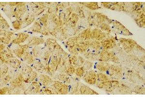 Immunohistochemistry of paraffin-embedded Mouse heart using ACTN1 Polyclonal Antibody at dilution of 1:100 (40x lens).