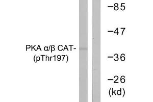 Western blot analysis of extracts from mouse brain cells using PKA α/β CAT (Phospho-Thr197) Antibody. (PRKACA antibody  (pThr197))