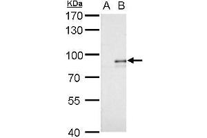 WB Image Alkyl-DHAP synthase antibody detects Alkyl-DHAP synthase protein by western blot analysis. (AGPS antibody)