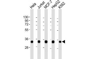 All lanes : Anti-HNRNL2 Antibody (N-Term) at 1:2000 dilution Lane 1: Hela whole cell lysate Lane 2: Jurkat whole cell lysate Lane 3: MCF-7 whole cell lysate Lane 4: HepG2 whole cell lysate Lane 5: K562 whole cell lysate Lysates/proteins at 20 μg per lane. (HNRNPA1L2 antibody  (AA 22-56))